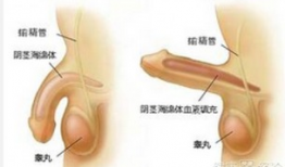 阴茎勃起硬度不够怎么办,提升阴茎勃起硬度的实用方法解析